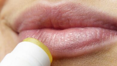 טיפול ומניעה: כך מתמודדים בהצלחה עם הרפס בשפתיים