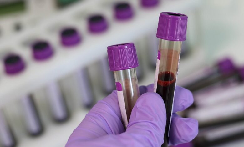 מחסור רפואי חדש: אין מספיק בדיקות לגילוי מחלת העגבת